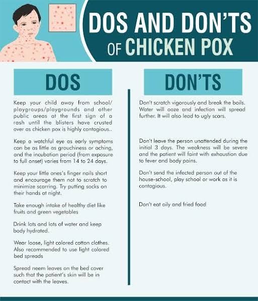 Dos and Don't s of Chicken Pox